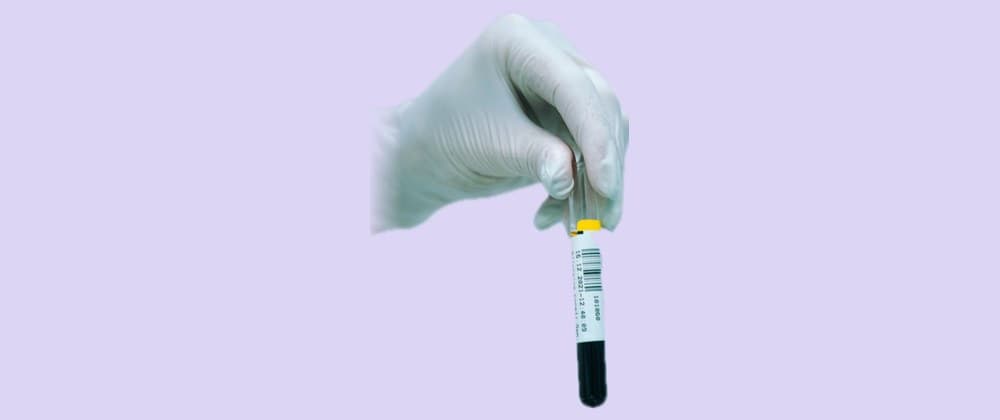 Lab Tests